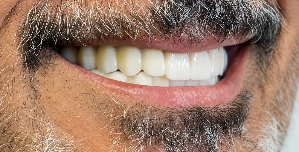 After dental treatment
